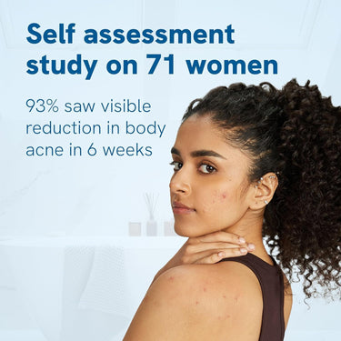 Be Bodywise 1% Salicylic Acid Exfoliating Body Wash Shower Gel 250ml | Prevents Body Acne, Bumpy skin & Deep cleanses | Suitable for All Skin Types.